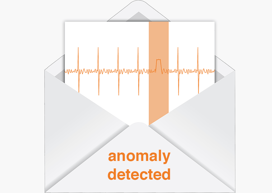 alert anomaly